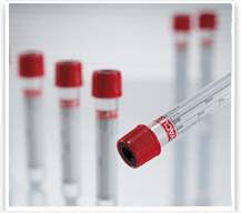 Tubes VACUETTE® Z Serum Sep Clot Activator Venous Blood Collection Tube Serum Tube Clot Activator / Separator Gel Additive 16 X 100 mm 9 mL Red / Yellow Ring Pull Cap Polyethylene Terephthalate (PET) Tube (50/PK 24PK/CS) by Greiner Bio-One  ID 455010P